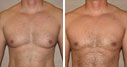 Before & After Photos